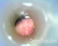 Video taken from the inside of a penis with endosc